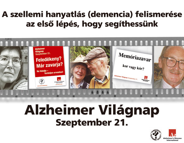 Alzheimer Világnap